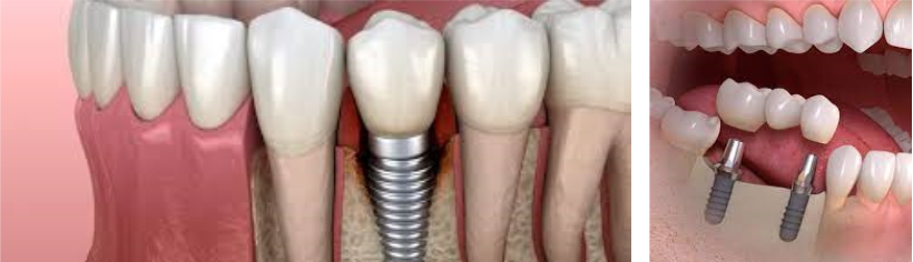 Dental Krišto